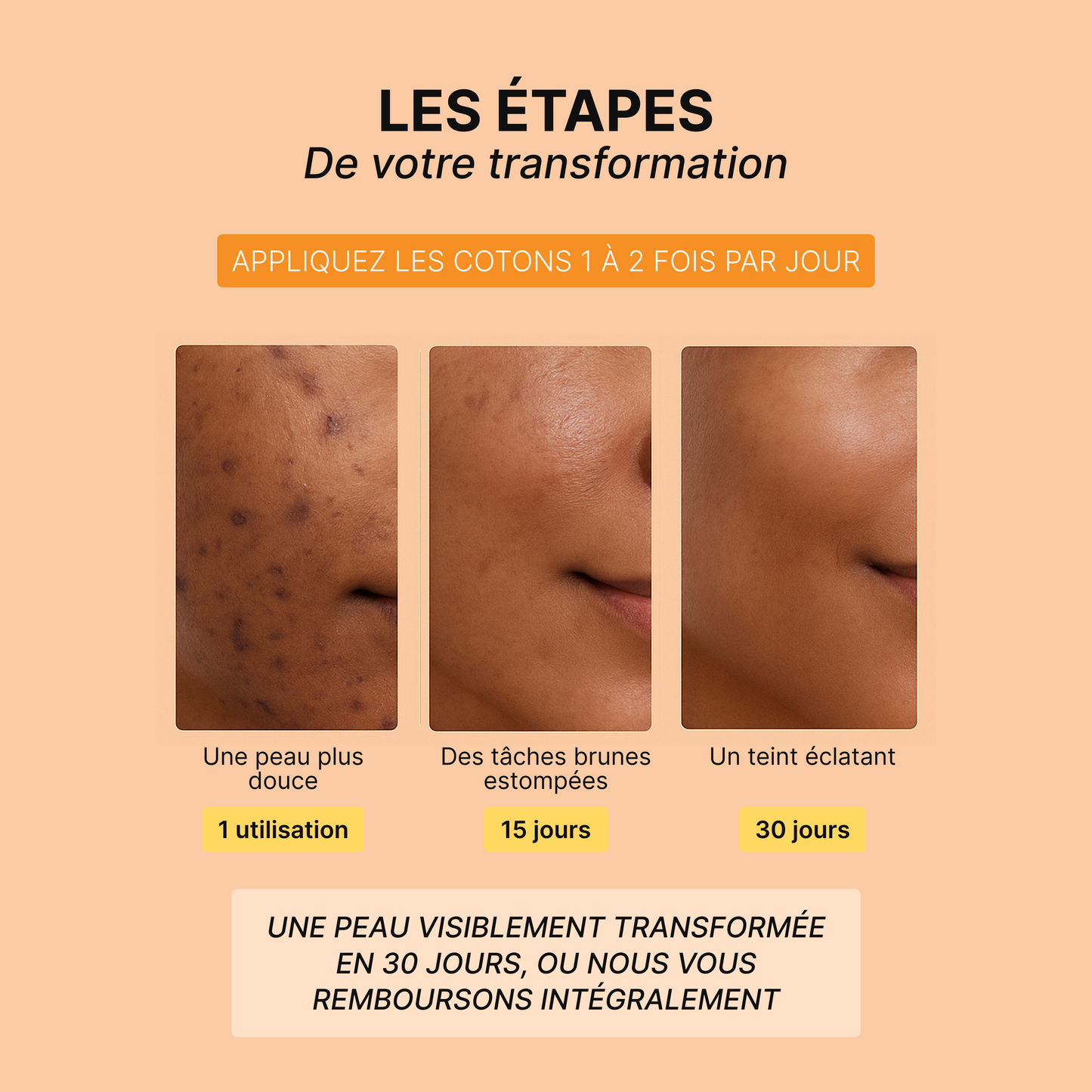 Routine Anti-Imperfections 4 en 1