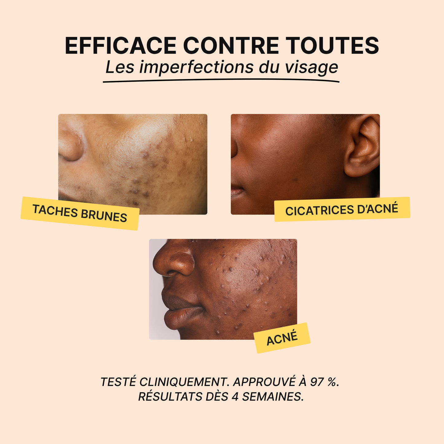 Routine Anti-Imperfections 4 en 1