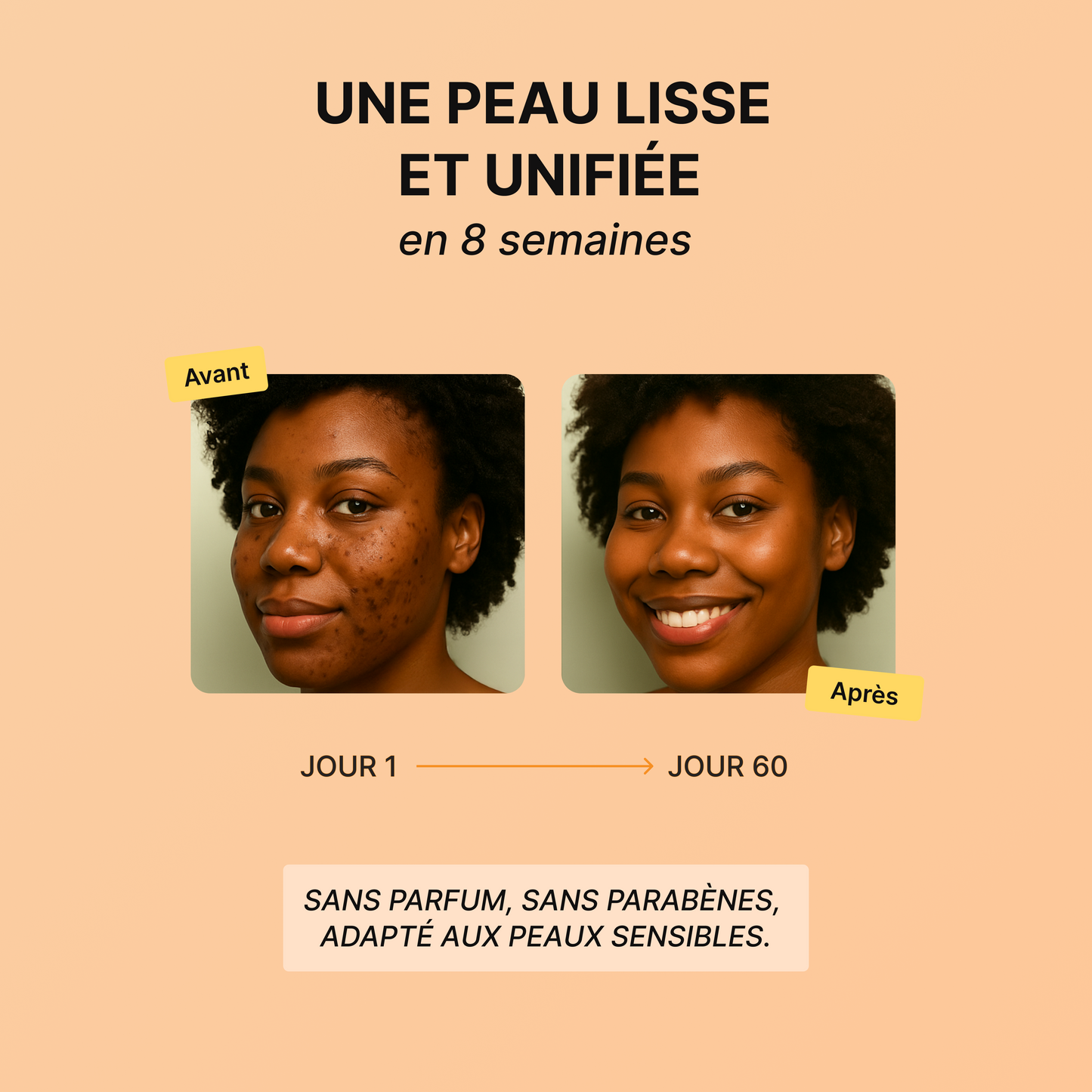 Routine Anti-Imperfections 4 en 1