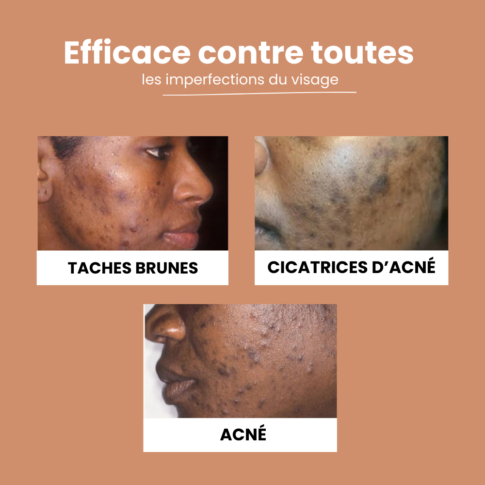 Routine Anti-Imperfections 4 en 1