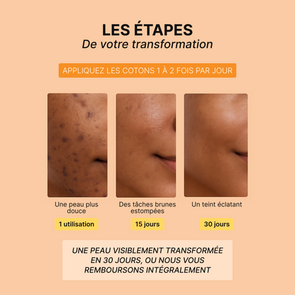 Routine Anti-Imperfections 4 en 1