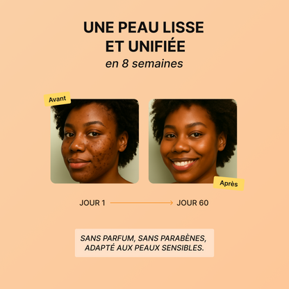Routine Anti-Imperfections 4 en 1