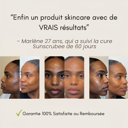 Routine Anti-Imperfections 4 en 1